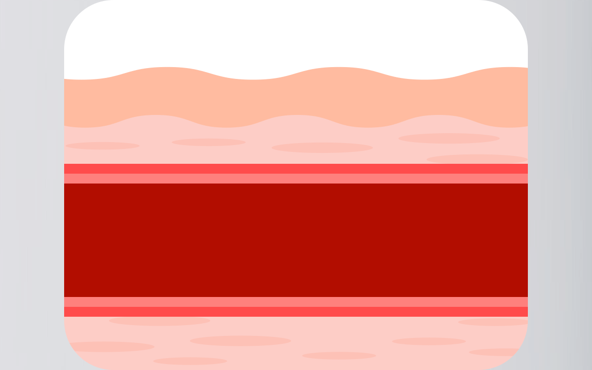 10.gif